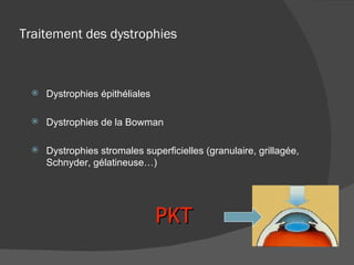 Traitement des dystrophies Dystrophies épithéliales Dystrophies de la Bowman Dystrophies stromales superficielles (granulaire, grillagée, Schnyder, gélatineuse…) PKT 