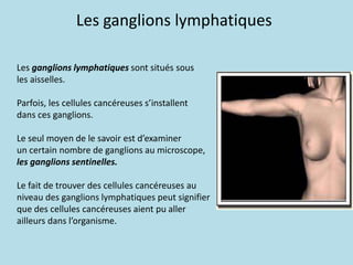 Les ganglions lymphatiques      Les ganglions lymphatiques sont situés sous	les aisselles.	Parfois, les cellules cancéreuses s’installent	dans ces ganglions.	Le seul moyen de le savoir est d’examiner	un certain nombre de ganglions au microscope,les ganglions sentinelles.	Le fait de trouver des cellules cancéreuses au 	niveau des ganglions lymphatiques peut signifier	que des cellules cancéreuses aient pu aller	ailleurs dans l’organisme.