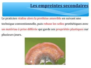 Les empreintes secondaires
Le praticien réalise alors la prothèse amovible en suivant une
technique conventionnelle, puis rebase les selles prothétiques avec
un matériau à prise différée qui garde ses propriétés plastiques sur
plusieurs jours.
 