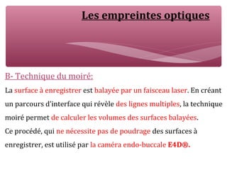 Les empreintes optiques
B- Technique du moiré:
La surface à enregistrer est balayée par un faisceau laser. En créant
un parcours d’interface qui révèle des lignes multiples, la technique
moiré permet de calculer les volumes des surfaces balayées.
Ce procédé, qui ne nécessite pas de poudrage des surfaces à
enregistrer, est utilisé par la caméra endo-buccale E4D®.
 