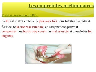 Les empreintes préliminaires
Essai et correction du PE :
Le PE est inséré en bouche plusieurs fois pour habituer le patient.
À l’aide de la cire rose ramollie, des adjonctions peuvent
compenser des bords trop courts ou mal orientés et d’englober les
trigones.
 