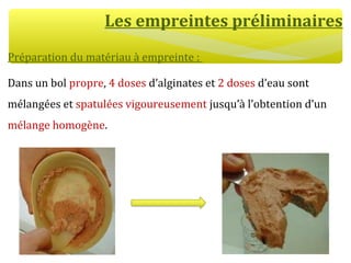 Les empreintes préliminaires
Préparation du matériau à empreinte :
Dans un bol propre, 4 doses d’alginates et 2 doses d’eau sont
mélangées et spatulées vigoureusement jusqu’à l’obtention d’un
mélange homogène.
 