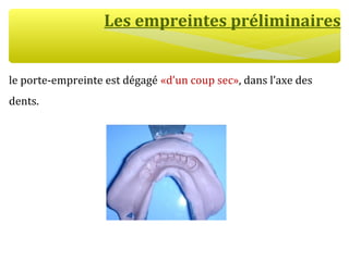 Les empreintes préliminaires
le porte-empreinte est dégagé «d’un coup sec», dans l’axe des
dents.
 