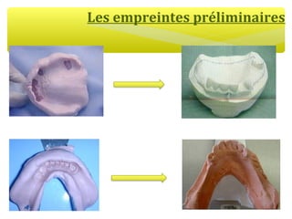 Les empreintes préliminaires
 