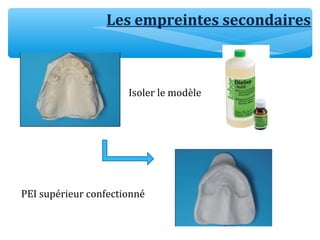 Les empreintes secondaires
Isoler le modèle
PEI supérieur confectionné
 