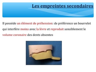 Les empreintes secondaires
Il possède un élément de préhension: de préférence un bourrelet
qui interfère moins avec la lèvre et reproduit sensiblement le
volume coronaire des dents absentes
 