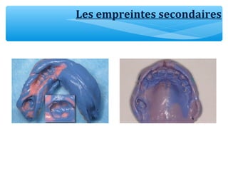 Les empreintes secondaires
 