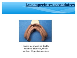 Les empreintes secondaires
Empreinte globale en double
viscosité des dents, et des
surfaces d’appui muqueuses.
 