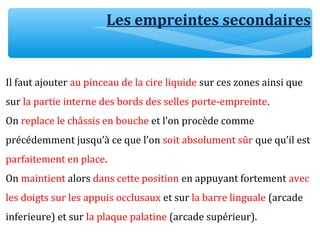 Il faut ajouter au pinceau de la cire liquide sur ces zones ainsi que
sur la partie interne des bords des selles porte-empreinte.
On replace le châssis en bouche et l’on procède comme
précédemment jusqu’à ce que l’on soit absolument sûr que qu’il est
parfaitement en place.
On maintient alors dans cette position en appuyant fortement avec
les doigts sur les appuis occlusaux et sur la barre linguale (arcade
inferieure) et sur la plaque palatine (arcade supérieur).
Les empreintes secondaires
 