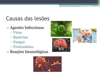 Causas das lesões
• Agentes Infecciosos
▫ Vírus
▫ Bactérias
▫ Fungos
▫ Protozoários
• Reações Imunológicas
 