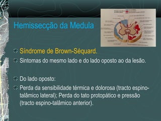Hemissecção da Medula
Síndrome de Brown-Séquard.
Sintomas do mesmo lado e do lado oposto ao da lesão.
Do lado oposto:
Perda da sensibilidade térmica e dolorosa (tracto espino-
talâmico lateral); Perda do tato protopático e pressão
(tracto espino-talâmico anterior).
 