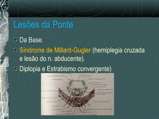 Lesões da Ponte
Da Base.
Síndrome de Millard-Gugler (hemiplegia cruzada
e lesão do n. abducente).
Diplopia e Estrabismo convergente)
 