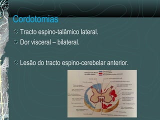 Cordotomias
Tracto espino-talâmico lateral.
Dor visceral – bilateral.
Lesão do tracto espino-cerebelar anterior.
 