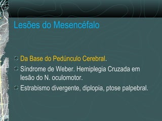 Lesões do Mesencéfalo
Da Base do Pedúnculo Cerebral.
Síndrome de Weber. Hemiplegia Cruzada em
lesão do N. oculomotor.
Estrabismo divergente, diplopia, ptose palpebral.
 