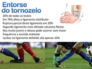20% de todas as lesões
Em 70% afeta o ligamento talofibular
Ruptura parcial deste ligamento em 20%
Segundo ligamento mais afetado calcaneo-fibular
Nos muito jovens e idosos pode ocorrer com maior
frequência a avulsão maleolar
Lesões no ligamento deltóide são apenas 10%
 