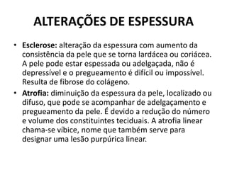 ALTERAÇÕES DE ESPESSURAEsclerose: alteração da espessura com aumento da consistência da pele que se torna lardácea ou coriácea. A pele pode estar espessada ou adelgaçada, não é depressível e o pregueamento é difícil ou impossível. Resulta de fibrose do colágeno.Atrofia: diminuição da espessura da pele, localizado ou difuso, que pode se acompanhar de adelgaçamento e pregueamento da pele. É devido a redução do número e volume dos constituintes teciduais. A atrofia linear chama-se víbice, nome que também serve para designar uma lesão purpúrica linear.