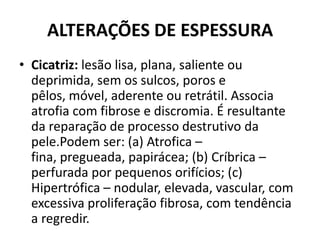 ALTERAÇÕES DE ESPESSURACicatriz: lesão lisa, plana, saliente ou deprimida, sem os sulcos, poros e pêlos, móvel, aderente ou retrátil. Associa atrofia com fibrose e discromia. É resultante da reparação de processo destrutivo da pele.Podem ser: (a) Atrofica – fina, pregueada, papirácea; (b) Críbrica – perfurada por pequenos orifícios; (c) Hipertrófica – nodular, elevada, vascular, com excessiva proliferação fibrosa, com tendência a regredir.