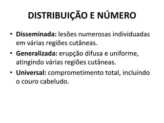 DISTRIBUIÇÃO E NÚMERODisseminada: lesões numerosas individuadas em várias regiões cutâneas.Generalizada: erupção difusa e uniforme, atingindo várias regiões cutâneas.Universal: comprometimento total, incluindo o couro cabeludo.