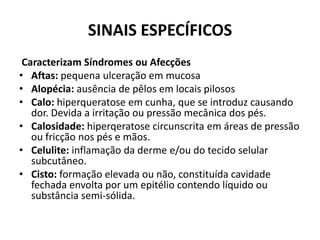 SINAIS ESPECÍFICOS Caracterizam Síndromes ou AfecçõesAftas: pequena ulceração em mucosaAlopécia: ausência de pêlos em locais pilososCalo:hiperqueratose em cunha, que se introduz causando dor. Devida a irritação ou pressão mecânica dos pés.Calosidade:hiperqeratose circunscrita em áreas de pressão ou fricção nos pés e mãos.Celulite: inflamação da derme e/ou do tecido selular subcutâneo.Cisto: formação elevada ou não, constituída cavidade fechada envolta por um epitélio contendo líquido ou substância semi-sólida.