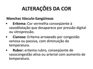 ALTERAÇÕES DA COR Manchas Vásculo-Sangüíneas•      Eritema: Cor vermelha conseqüente à vasodilatação que desaparece por pressão digital ou vitropressão.•      Cianose: Eritema arroxeado por congestão venosa ou passiva, com diminuição da temperatura.•      Rubor: eritema rubro, conseqüente de vasocongestão ativa ou arterial com aumento de temperatura.