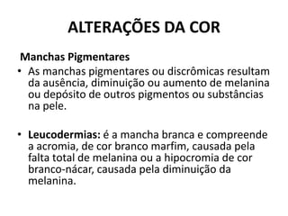 ALTERAÇÕES DA COR Manchas PigmentaresAs manchas pigmentares ou discrômicas resultam da ausência, diminuição ou aumento de melanina ou depósito de outros pigmentos ou substâncias na pele. Leucodermias: é a mancha branca e compreende a acromia, de cor branco marfim, causada pela falta total de melanina ou a hipocromia de cor branco-nácar, causada pela diminuição da melanina.