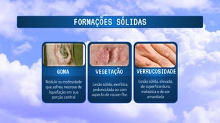 FORMAÇÕES SÓLIDAS
Nódulo ou nodosidade
que sofreu necrose de
liquefação em sua
porção central
Lesão sólida, exofítica,
pedunculada ou com
aspecto de couve-flor.
Lesão sólida, elevada,
de superfície dura,
inelástica e de cor
amarelada
GOMA VEGETAÇÃO VERRUCOSIDADE
 