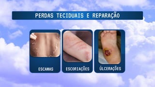 PERDAS TECIDUAIS E REPARAÇÃO
ESCAMAS ÚLCERAÇÕES
ESCORIAÇÕES
 