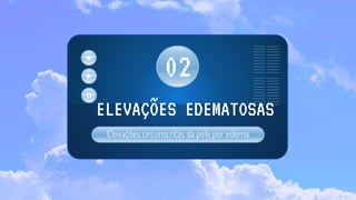 Elevações circunscritas da pele por edema
ELEVAÇÕES EDEMATOSAS
02
 