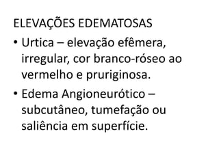 ELEVAÇÕES EDEMATOSAS
• Urtica – elevação efêmera,
irregular, cor branco-róseo ao
vermelho e pruriginosa.
• Edema Angioneurótico –
subcutâneo, tumefação ou
saliência em superfície.
 