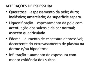 ALTERAÇÕES DE ESPESSURA
• Queratose – espessamento da pele; duro;
inelástico; amarelado; de superfície áspera.
• Liquenificação – espessamento da pele com
acentuação dos sulcos e da cor normal;
aspecto quadriculado.
• Edema – aumento de espessura depressível;
decorrente do extravasamento de plasma na
derme e/ou hipoderme.
• Infiltração – aumento de espessura com
menor evidência dos sulcos.
 