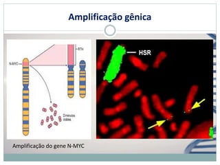 Amplificação gênica
Amplificação do gene N-MYC
 