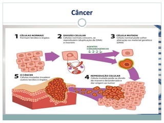 Câncer
 