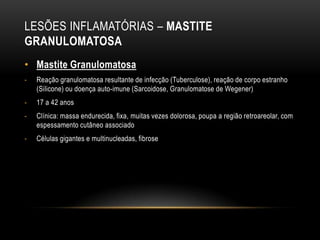 LESÕES INFLAMATÓRIAS – MASTITE
GRANULOMATOSA
• Mastite Granulomatosa
- Reação granulomatosa resultante de infecção (Tuberculose), reação de corpo estranho
(Silicone) ou doença auto-imune (Sarcoidose, Granulomatose de Wegener)
- 17 a 42 anos
- Clínica: massa endurecida, fixa, muitas vezes dolorosa, poupa a região retroareolar, com
espessamento cutâneo associado
- Células gigantes e multinucleadas, fibrose
 