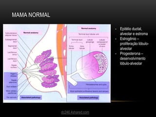 MAMA NORMAL
dc246.4shared.com
- Epitélio ductal,
alveolar e estroma
- Estrogênio –
proliferação lóbulo-
alveolar
- Progesterona –
desenvolvimento
lóbulo-alveolar
 