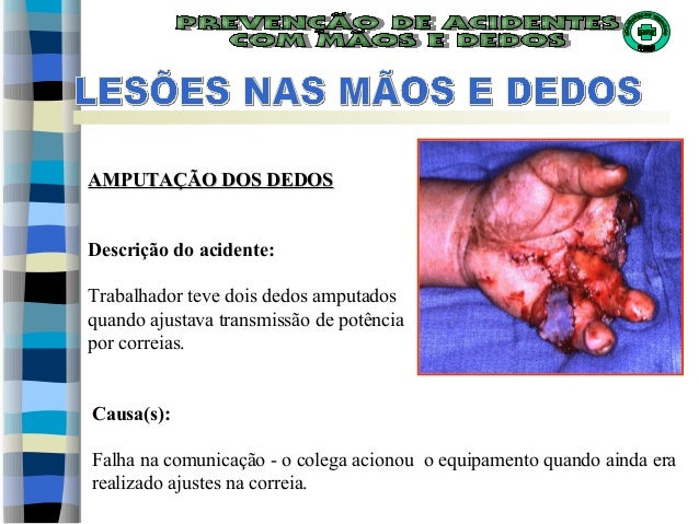 Lesões nas mãos