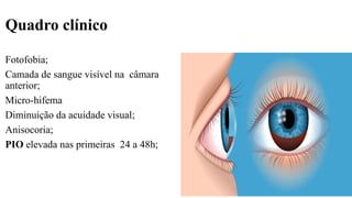 Quadro clínico
Fotofobia;
Camada de sangue visível na câmara
anterior;
Micro-hifema
Diminuição da acuidade visual;
Anisocoria;
PIO elevada nas primeiras 24 a 48h;
 