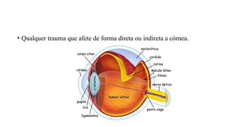 • Qualquer trauma que afete de forma direta ou indireta a córnea.
 