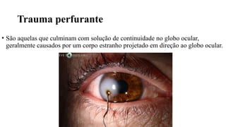Trauma perfurante
• São aquelas que culminam com solução de continuidade no globo ocular,
geralmente causados por um corpo estranho projetado em direção ao globo ocular.
 