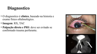 Diagnostico
• O diagnostico é clínico, baseado na historia e
exame físico oftalmológico.
• Imagem: RX, TAC
• Palpação direta e PIO: deve ser evitado se
confirmado trauma perfurante.
 