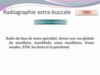Radiographie extra-buccale De face
Incidence de BLONDEAU
Réalisation:
 