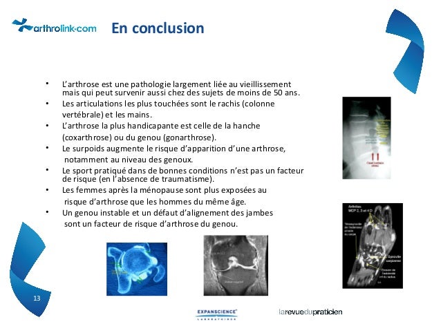 Les facteurs de risque de l’arthrose Les facteurs de risque de l’arthrose