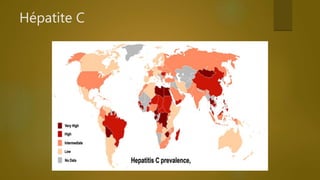 Hépatite C
 