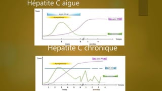 Hépatite C aigue
Hépatite C chronique
 