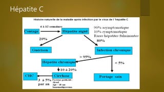 Hépatite C aigue
Hépatite C chronique
 
