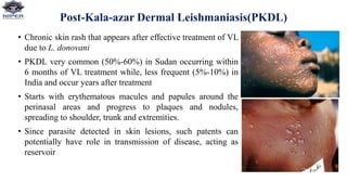 Post-Kala-azar Dermal Leishmaniasis(PKDL)
• Chronic skin rash that appears after effective treatment of VL
due to L. donovani
• PKDL very common (50%-60%) in Sudan occurring within
6 months of VL treatment while, less frequent (5%-10%) in
India and occur years after treatment
• Starts with erythematous macules and papules around the
perinasal areas and progress to plaques and nodules,
spreading to shoulder, trunk and extremities.
• Since parasite detected in skin lesions, such patents can
potentially have role in transmission of disease, acting as
reservoir
 