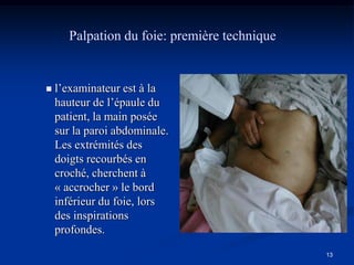 Palpation du foie: première technique


   l’examinateur est à la
    hauteur de l’épaule du
    patient, la main posée
    sur la paroi abdominale.
    Les extrémités des
    doigts recourbés en
    croché, cherchent à
    « accrocher » le bord
    inférieur du foie, lors
    des inspirations
    profondes.
                                               13
 