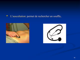 •   L’auscultation: permet de rechercher un souffle,




                                                       16
 