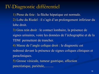 IV-Diagnostic différentiel
   1) Ptose du foie : la flèche hépatique est normale.
   2) Lobe du Riedel : il s’agit d’un prolongement inférieur du
   lobe droit.
   3) Gros rein droit : le contact lombaire, la présence de
   signes urinaires, voire les données de l’échographie et de la
   TDM permettent de trancher.
   4) Masse de l’angle colique droit : le diagnostic est
   redressé devant la présence de signes coliques cliniques et
   paracliniques.
   5) Grosse vésicule, tumeur gastrique, affection
   pancréatique, pariétale,……..
                                                              19
 