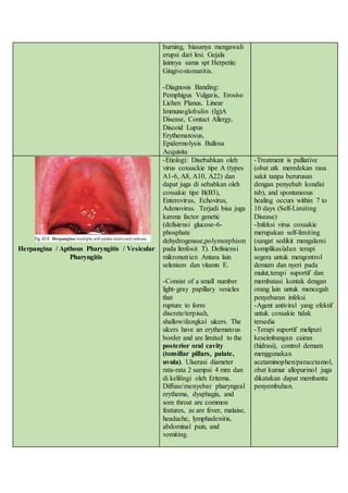 Lesi Rongga Mulut Akibat Virus | DOCX
