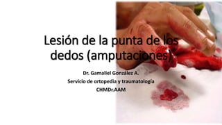 Lesión de la punta de los 
dedos (amputaciones) 
Dr. Gamaliel González A. 
Servicio de ortopedia y traumatología 
CHMDr.AAM 
 